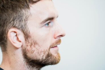 アルバルク東京 ザック・バランスキーが語る、迷彩もピンクも自分らしく～バッシュとファッション/フランチャイズプレイヤーが語るB.LEAGUEの10年 vol.03 Alpen Group Magazine