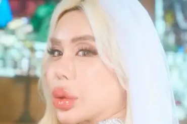 アレン様　衝撃の月額美容代「40～50万とかザラに。エステも16万くらい」若槻千夏「何すんの？」 - スポニチ Sponichi Annex 芸能