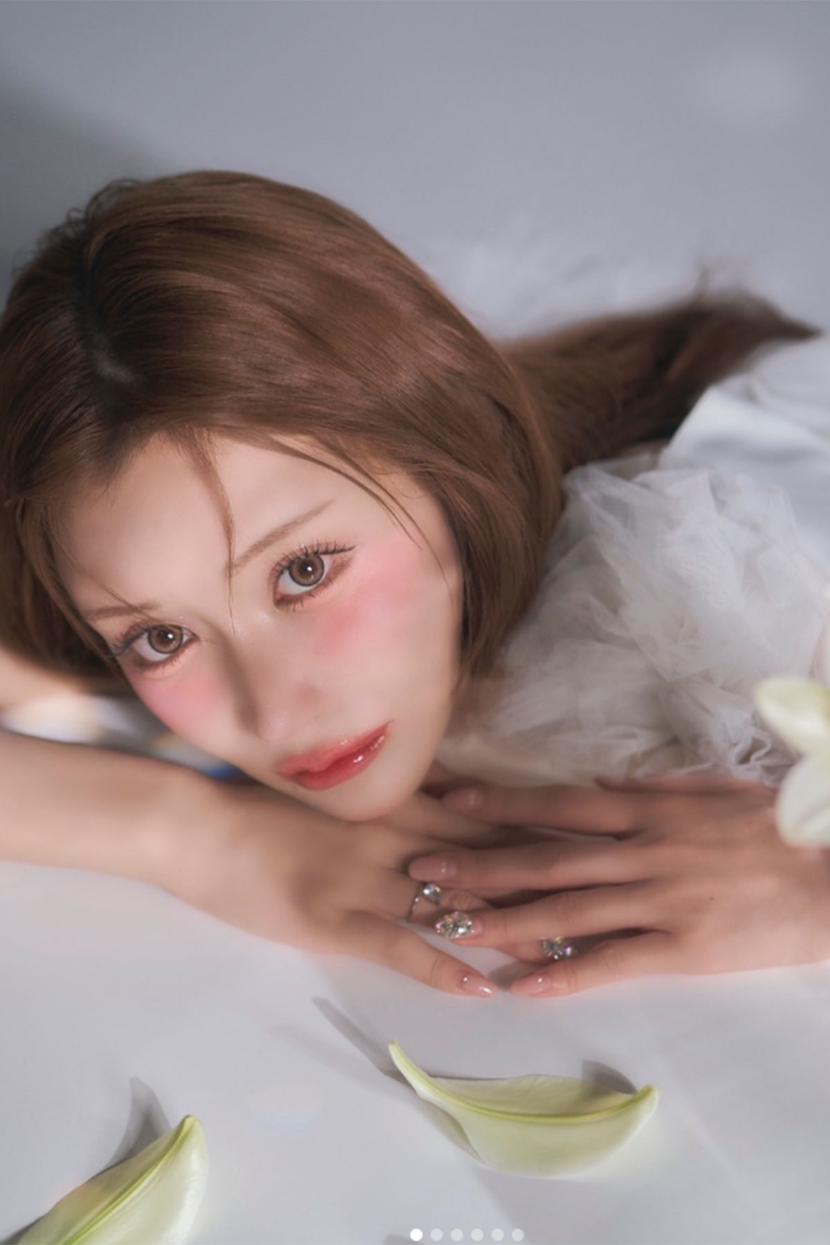 明日花キララ「死んじゃいけない」　美容整形の全身麻酔でパニック、前歯が欠けた姿に「そこまでして」分かれる賛否