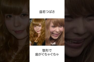 実は整形に失敗した芸能人10選#shorts #雑学
