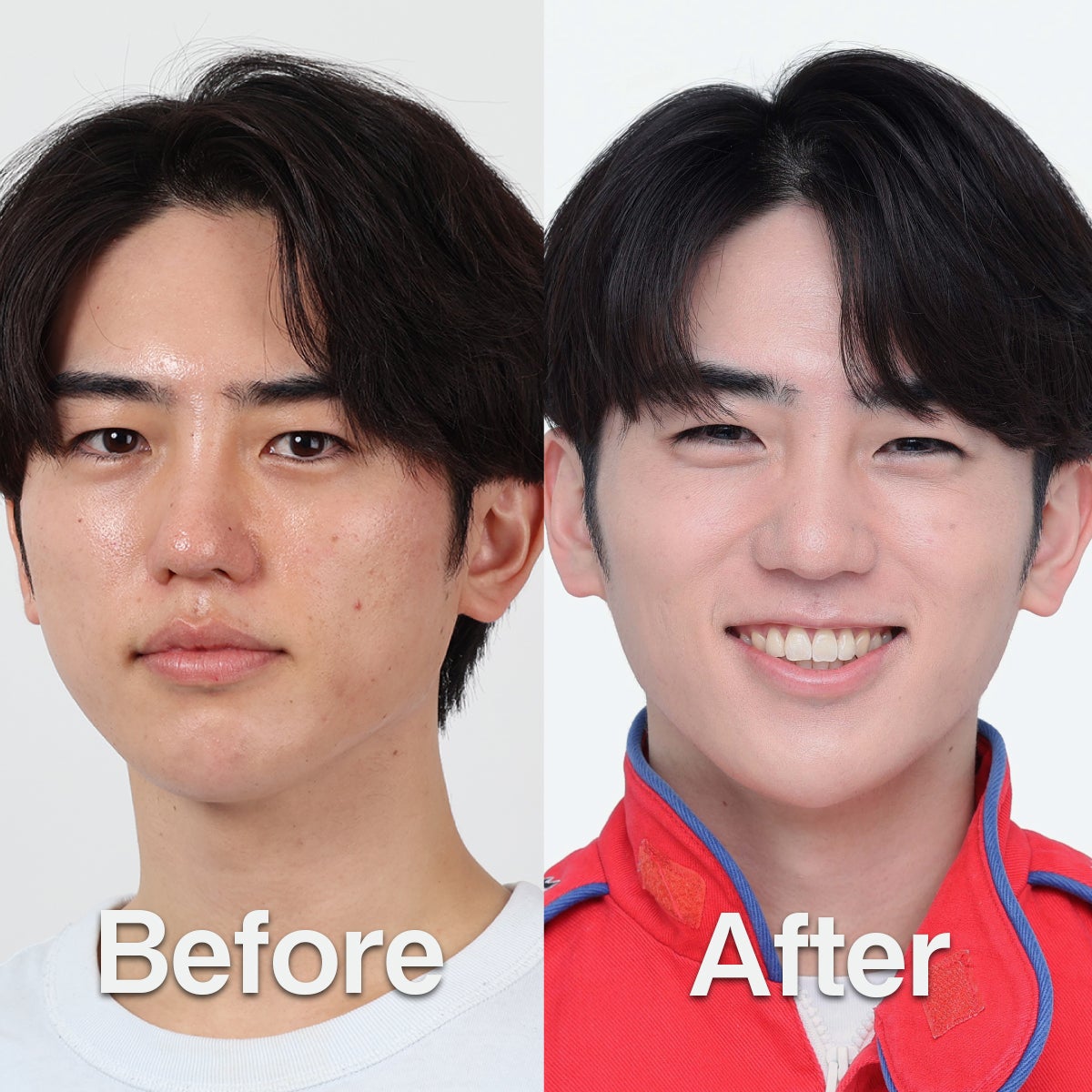 メンズスキンケアブランドDISM　中野一輝さんのビフォー・アフター