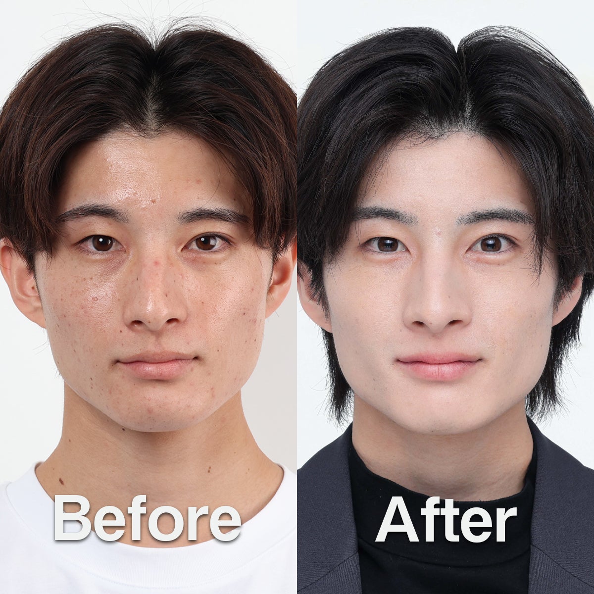 メンズスキンケアブランドDISM　赤穂隼人さんのビフォー・アフター