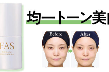 新作「FAS ザ ブラック ブライトセラム Ⅱ」の効果は？ 30日間使ってシミ個数の変化を公開