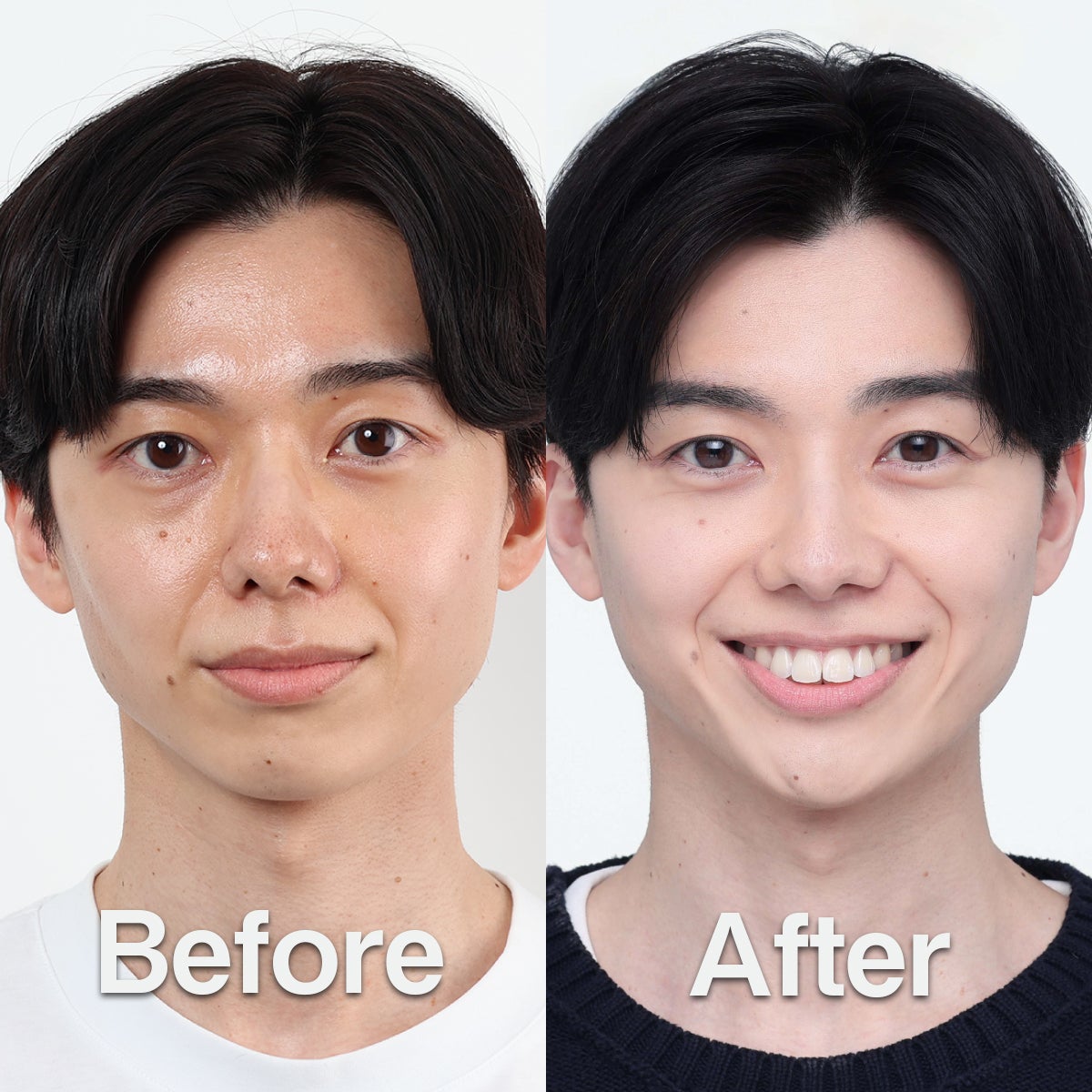 メンズスキンケアブランドDISM　佐藤友彦さんのビフォー・アフター