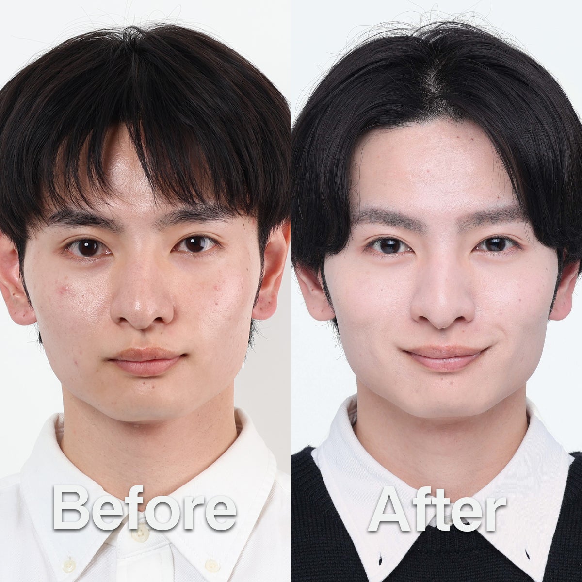 メンズスキンケアブランドDISM　西将太さんのビフォー・アフター