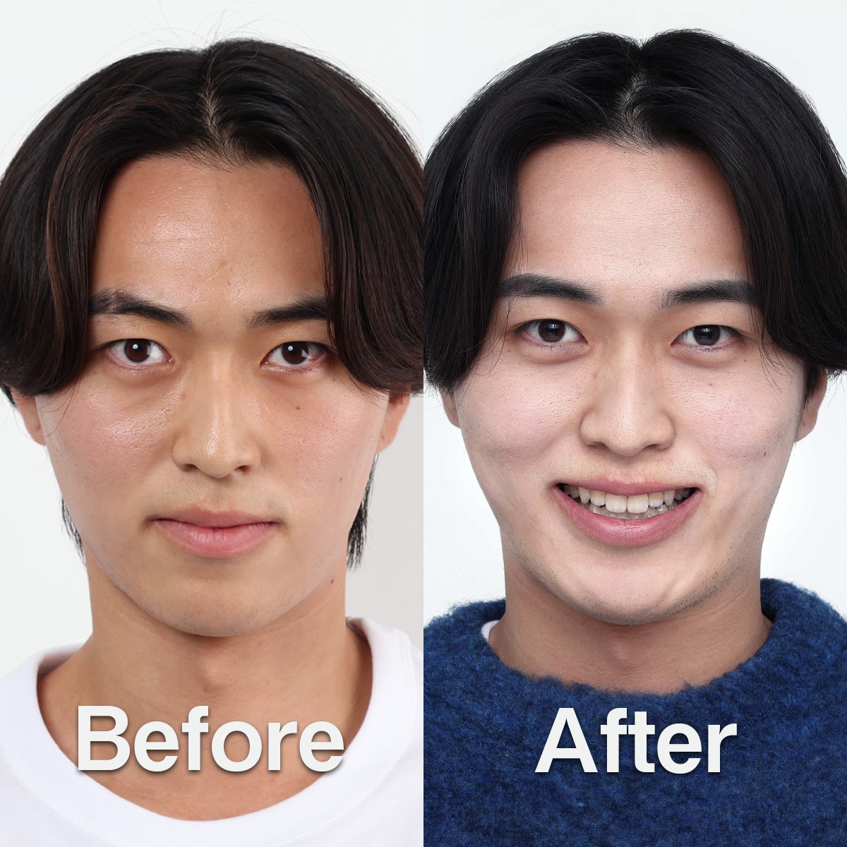 メンズスキンケアブランドDISM　三宅潤一郎さんのビフォー・アフター