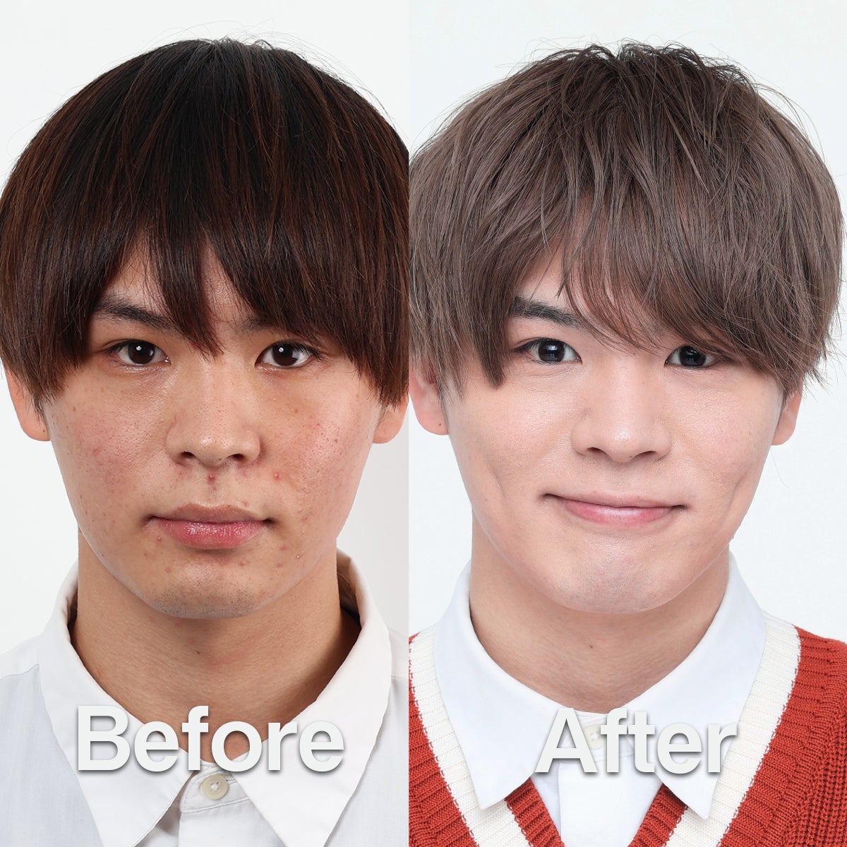 メンズスキンケアブランドDISM　ひだかさんのビフォー・アフター