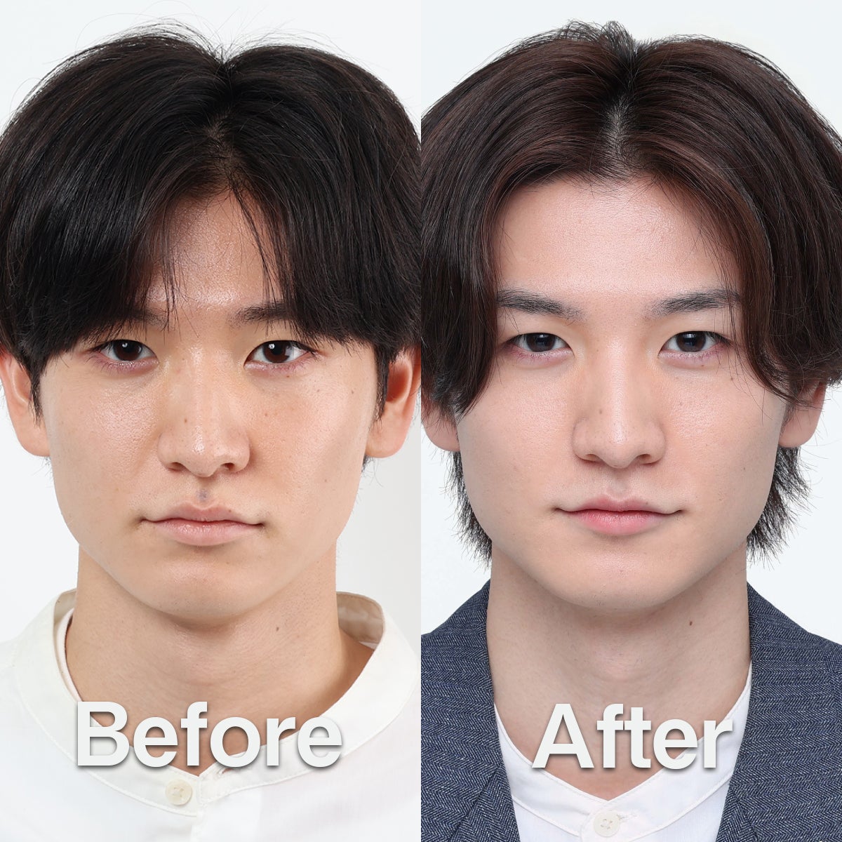 メンズスキンケアブランドDISM　大田侑吾さんのビフォー・アフター