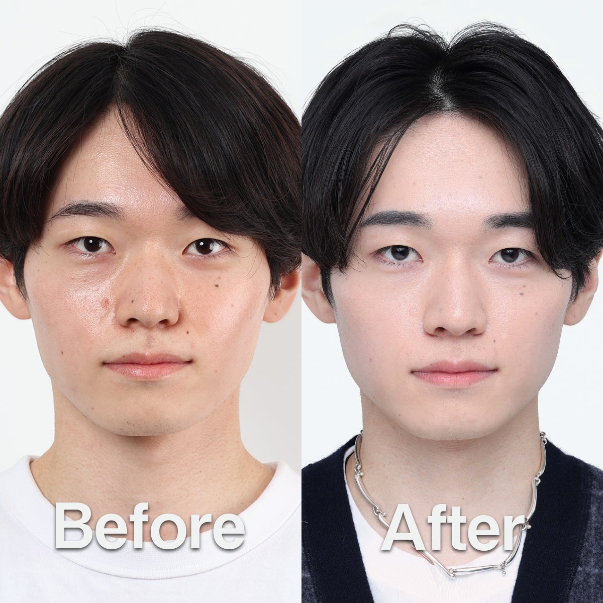 メンズスキンケアブランドDISM　浅野靖崇さんのビフォー・アフター