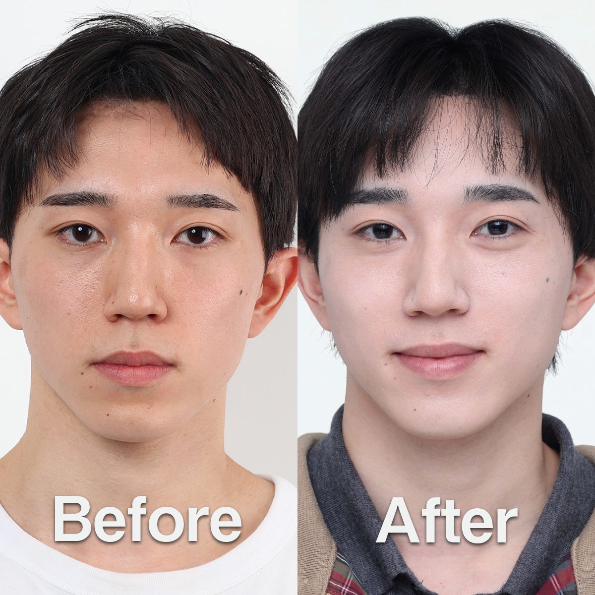 メンズスキンケアブランドDISM　伊藤利将さんのビフォー・アフター