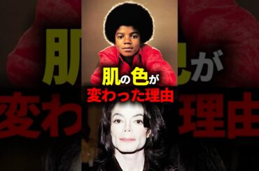 マイケルジャクソンの肌が白くなった衝撃の理由