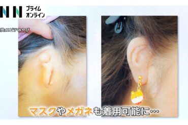 外見に「自信」取り戻し、憧れの結婚指輪写真も…「エピテーゼ」制作現場を山﨑夕貴キャスターが取材（2026年04月03日）