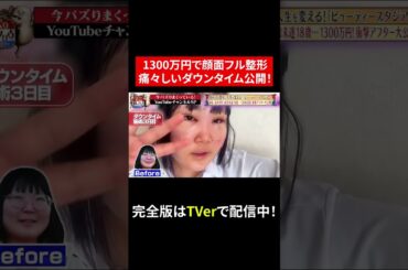 【じっくり聞いタロウ】1300万円でフル整形！痛々しいダウンタイム…