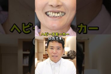 重度の歯周病に悩むヘビースモーカーの女性の歯を全て抜いて機能回復した症例