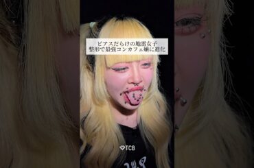 【二重整形】ピアスだらけの地雷系女子が整形で最強コンカフェ嬢に進化🥰✨#shorts